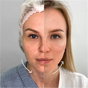 "Beautyway clinic", клиника эстетической косметологии