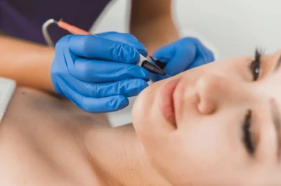 Электроэпиляция пробная процедура