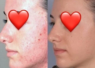 Krasa Line (Косметология )