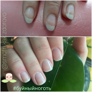 Буйный ноготь (Ногтевая студия)