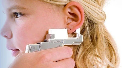 Прокол мочек ушей по "Системе 75" в клинике мужского и женского здоровья "ОнисМед"