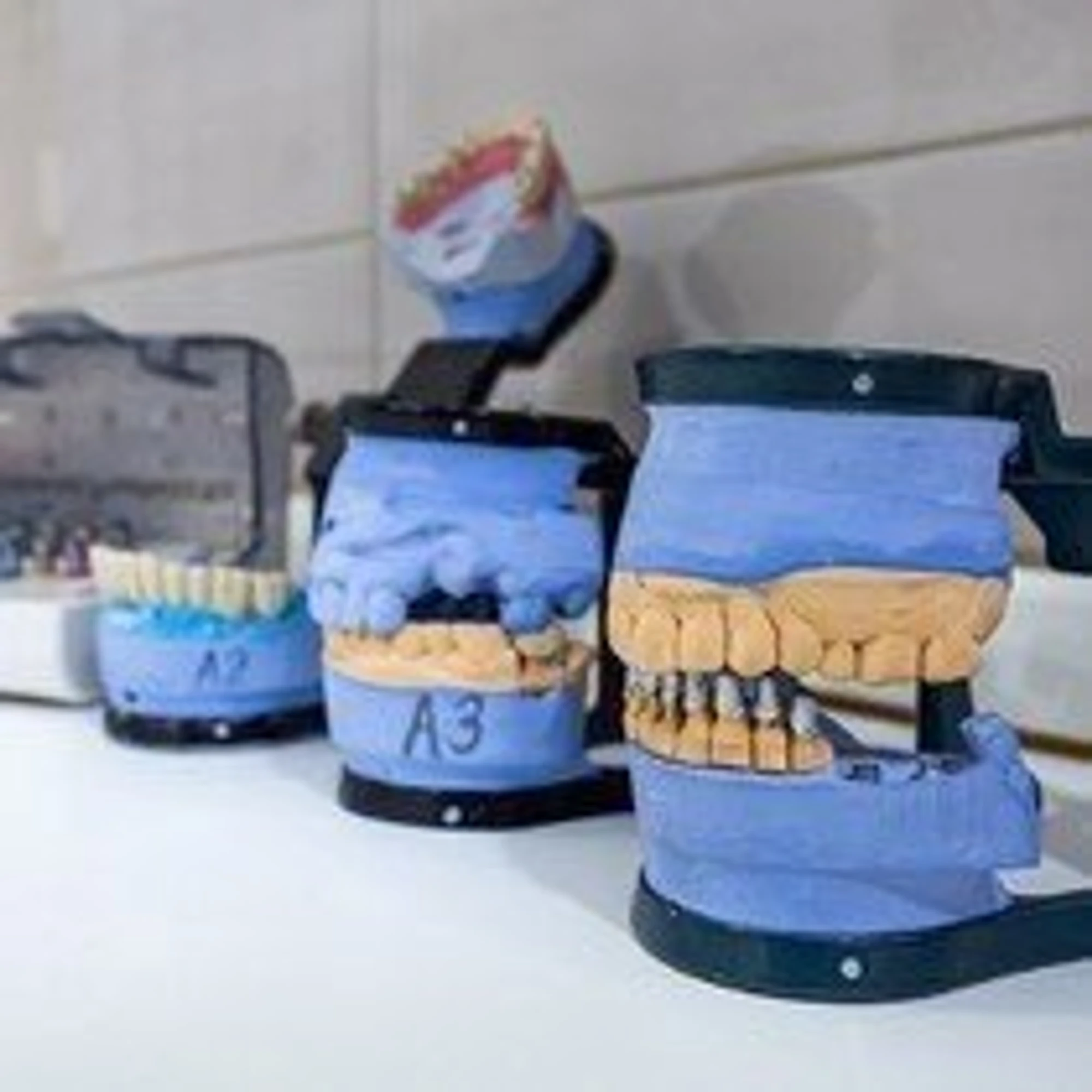 Имплант "Под ключ" по акции в стоматологии "ИРИОКС"