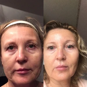 Салон Красоты (Косметология)