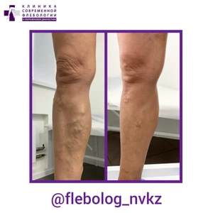 Клиника современной флебологии и ультразвуковой диагностики (Медцентр, клиника )